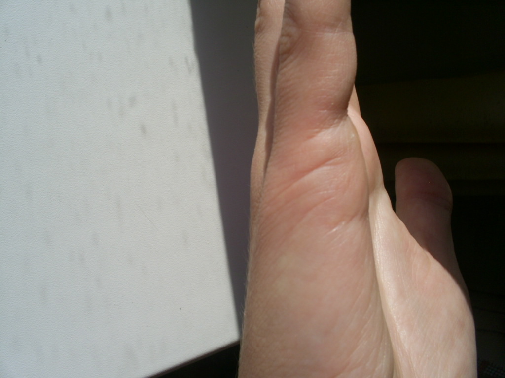 Линии брака.JPG