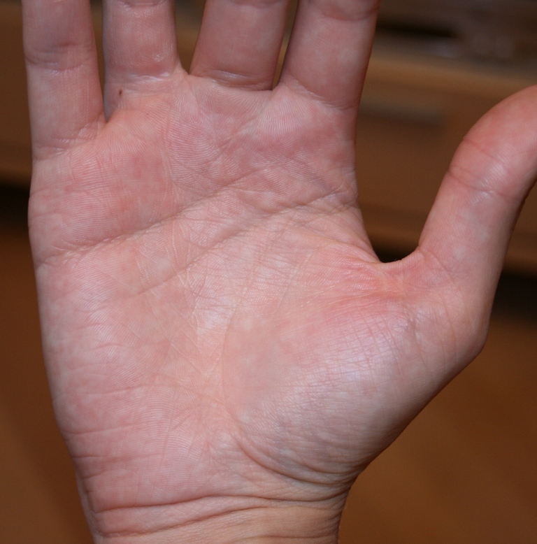 правая ладонь.JPG