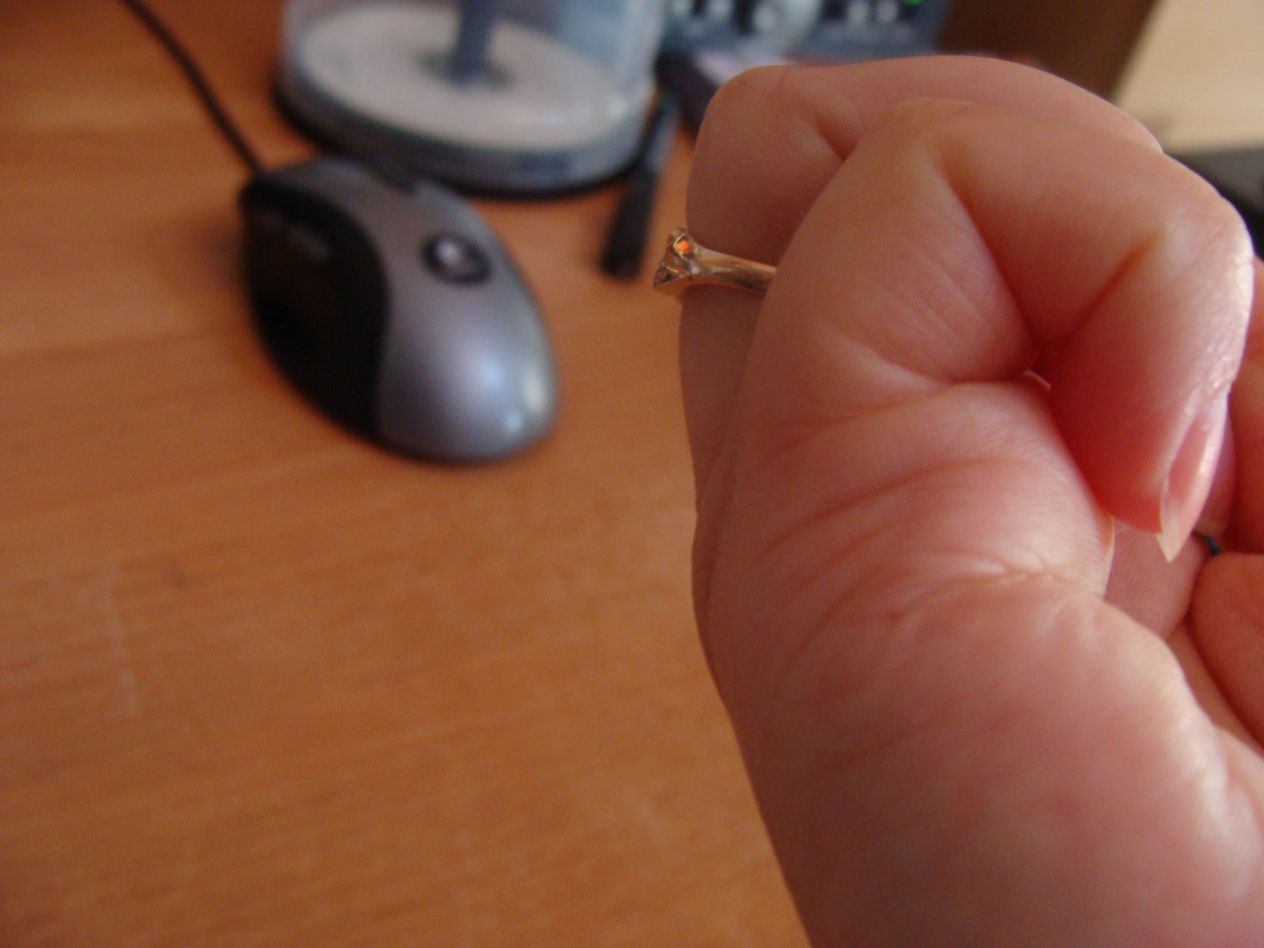 правая мизинец.JPG