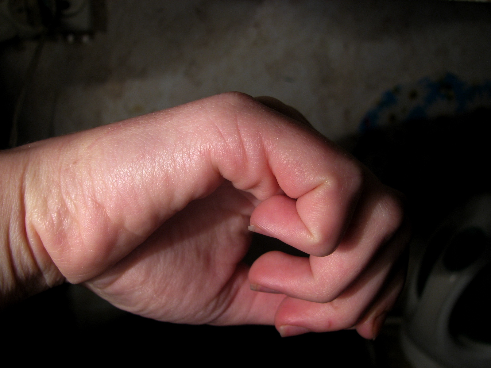 правое ребро.jpg