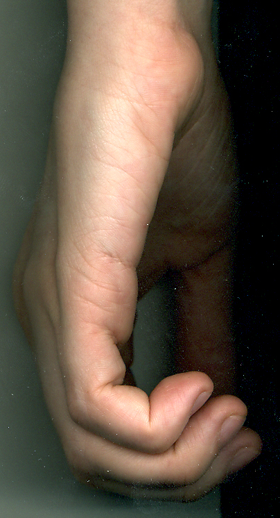 ребро левой.jpg