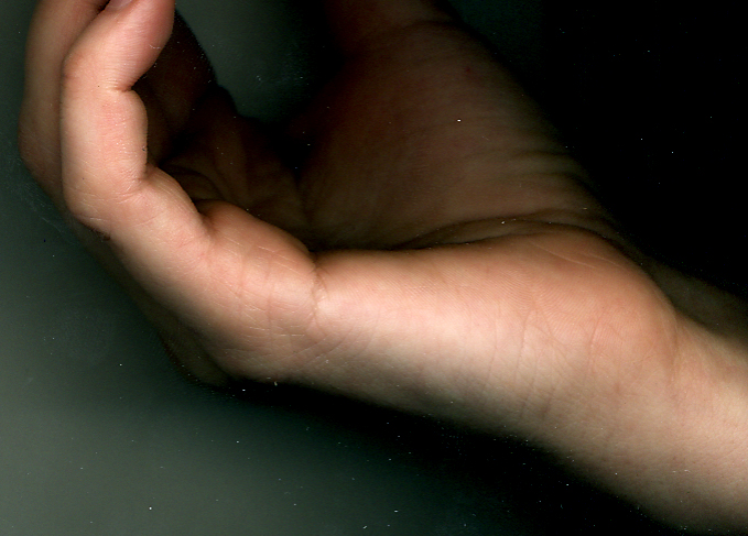 ребро правой.jpg