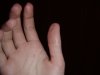right_thumb.JPG