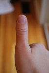 right thumb2.jpg