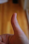 right_thumb1.jpg